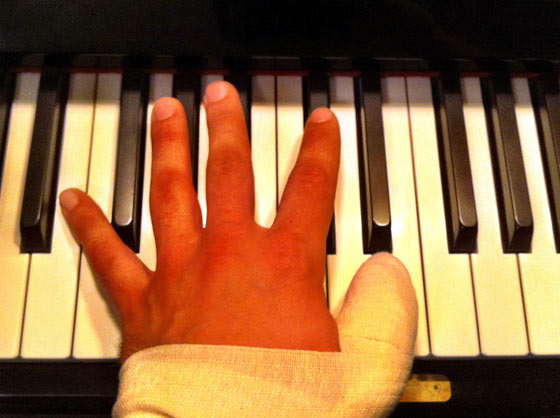 انگشت شکسته پیانو